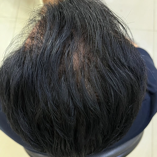 After